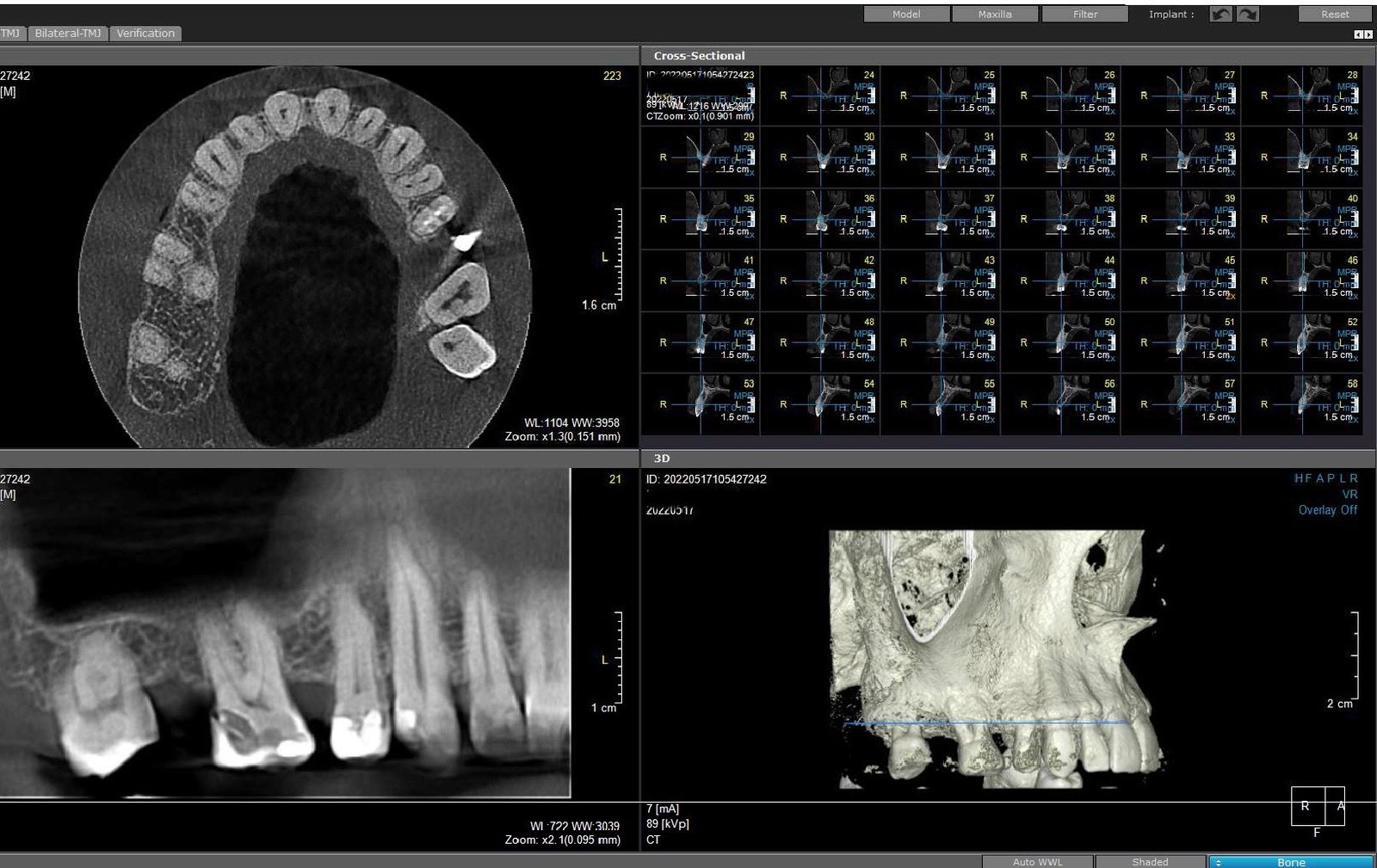 3d cbct